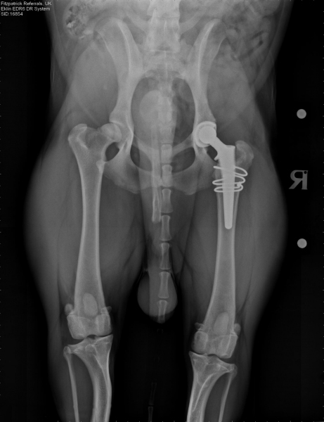 Post-Surgery X-Ray showing Willow's new hip joint.