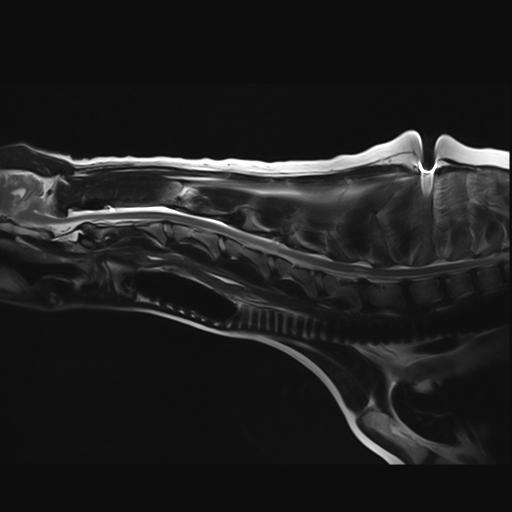 MRI scan of Ellie's neck.