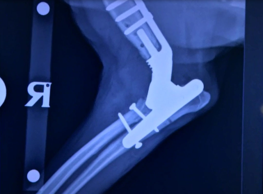 X-Ray image of Bodie's leg after the total elbox replacement with the new implant in place