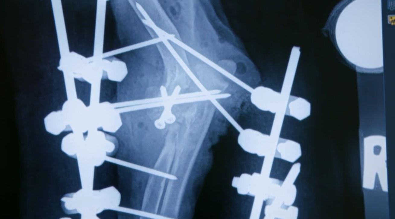 X-ray images of puppy's elbow postop